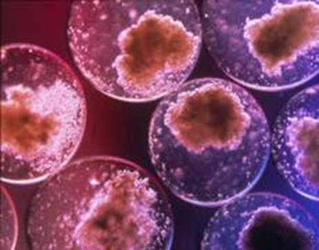  Scoperta una nuova funzione del gene Otx2 nelle cellule staminali embrionali